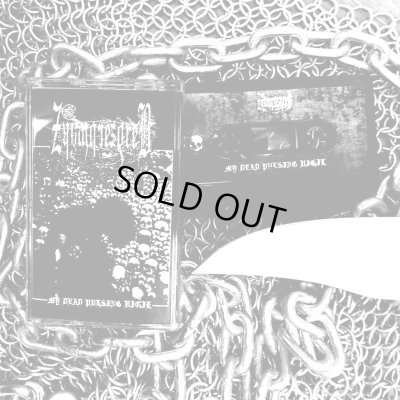 画像1: Zkywbrezdreb - My Dead Pulsing Vigil / ProTape