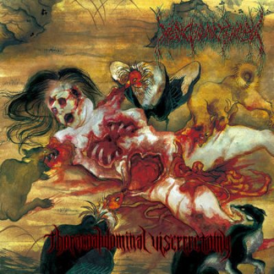 画像1: Medic Vomiting Pus - Thoracoabdominal Viscerectomy / LP