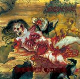 [BCE 007] Medic Vomiting Pus - Thoracoabdominal Viscerectomy / DigiSleeveCD